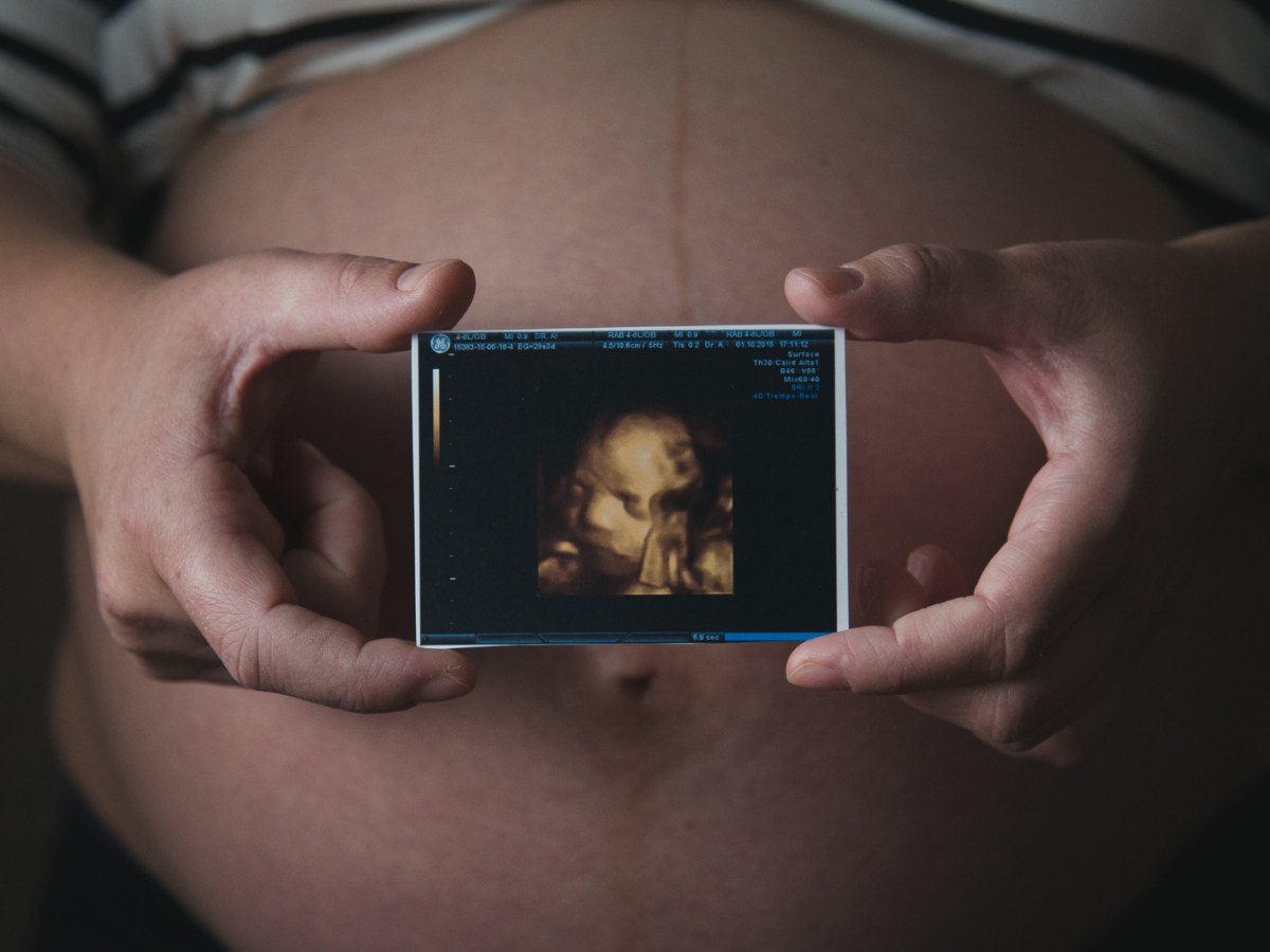 Eine schwangere Frau hält ein 3-D-Ultraschallbild vor ihren Bauch.