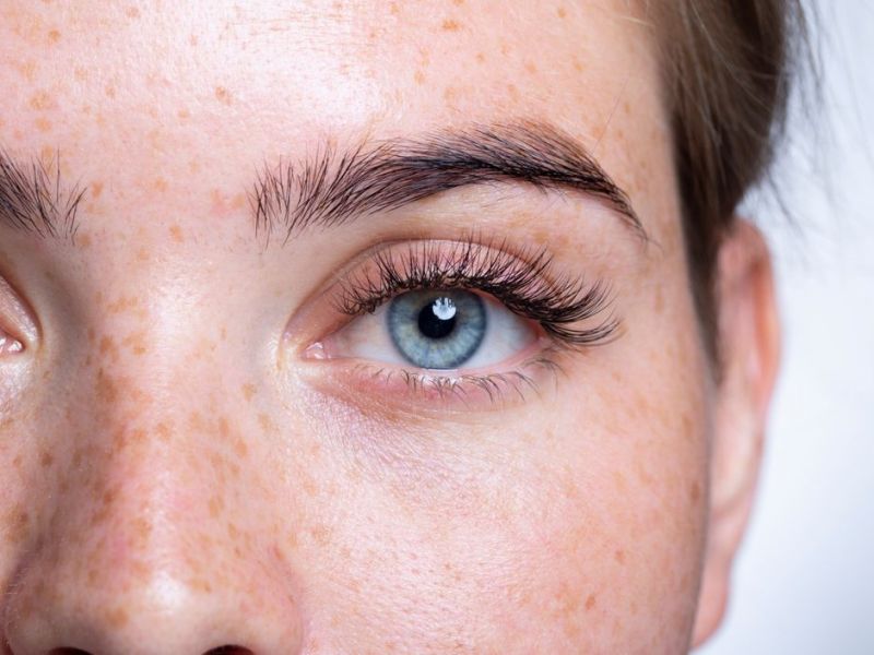 Nahaufnahme von Frau mit blauen Augen und Sommersprossen