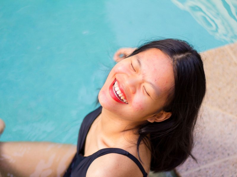 Schöne Frau beim Sonnenbaden mit unreiner Haut.