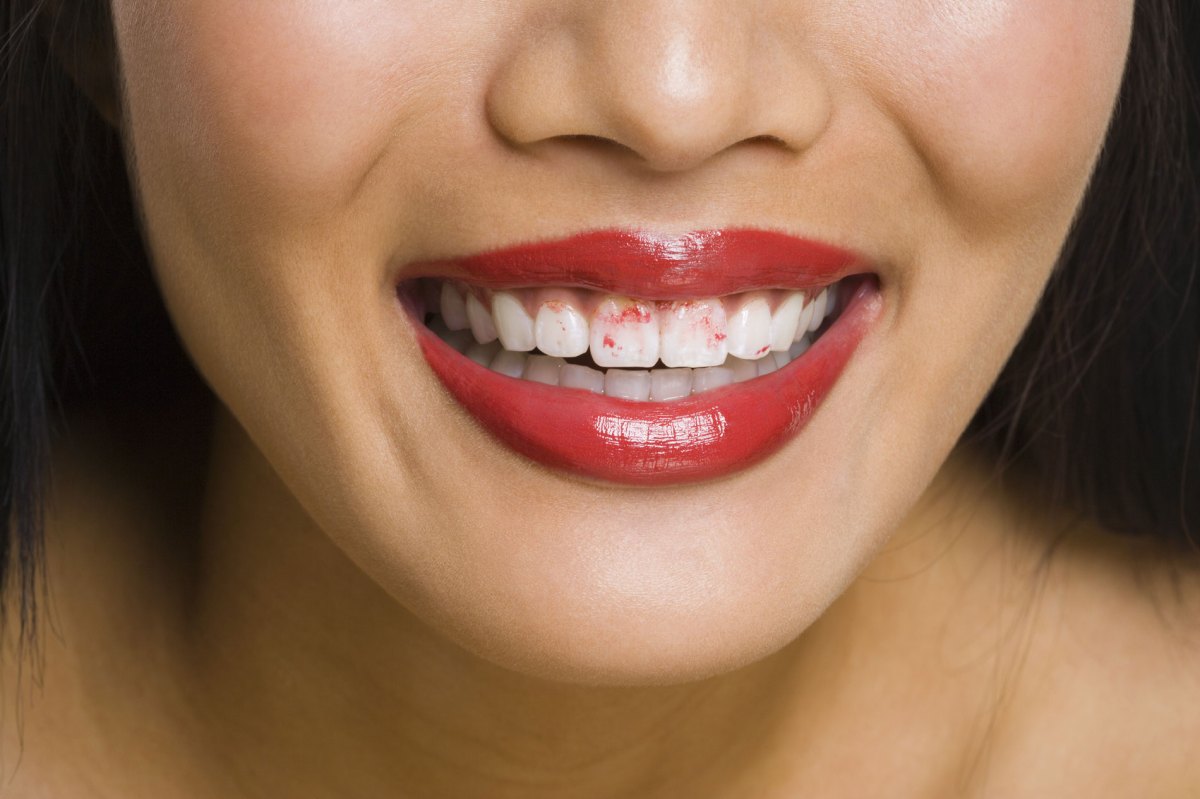 Frau mit rotem Lippenstift und Lippenstift-Flecken auf den Zähnen.
