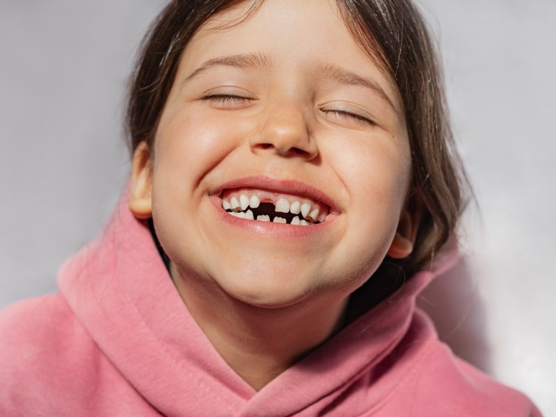 Porträt eines lachenden Kindes mit einer Zahnlücke.