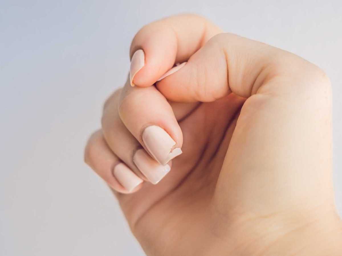 Rosa lackierte Fingern&auml;gel, von denen einer eingerissen ist