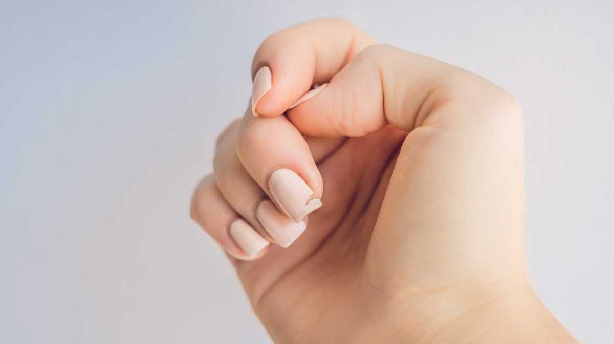 Rosa lackierte Fingernägel, von denen einer eingerissen ist