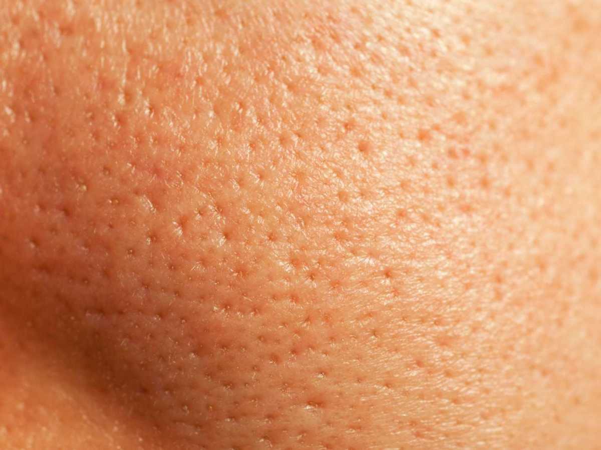 Glatte Haut trotz großer Poren – mit diesen Make-up-Hacks klappt’s.