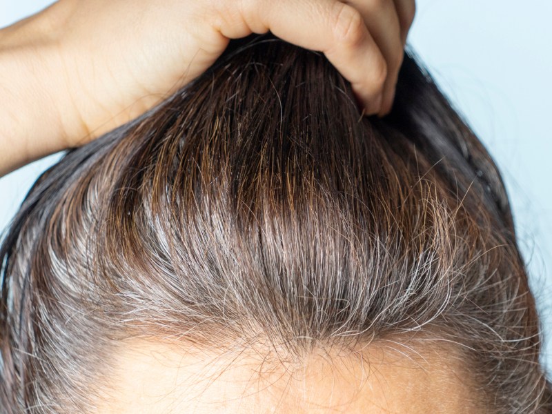 Frau mit grauen Haaren am Haaransatz.