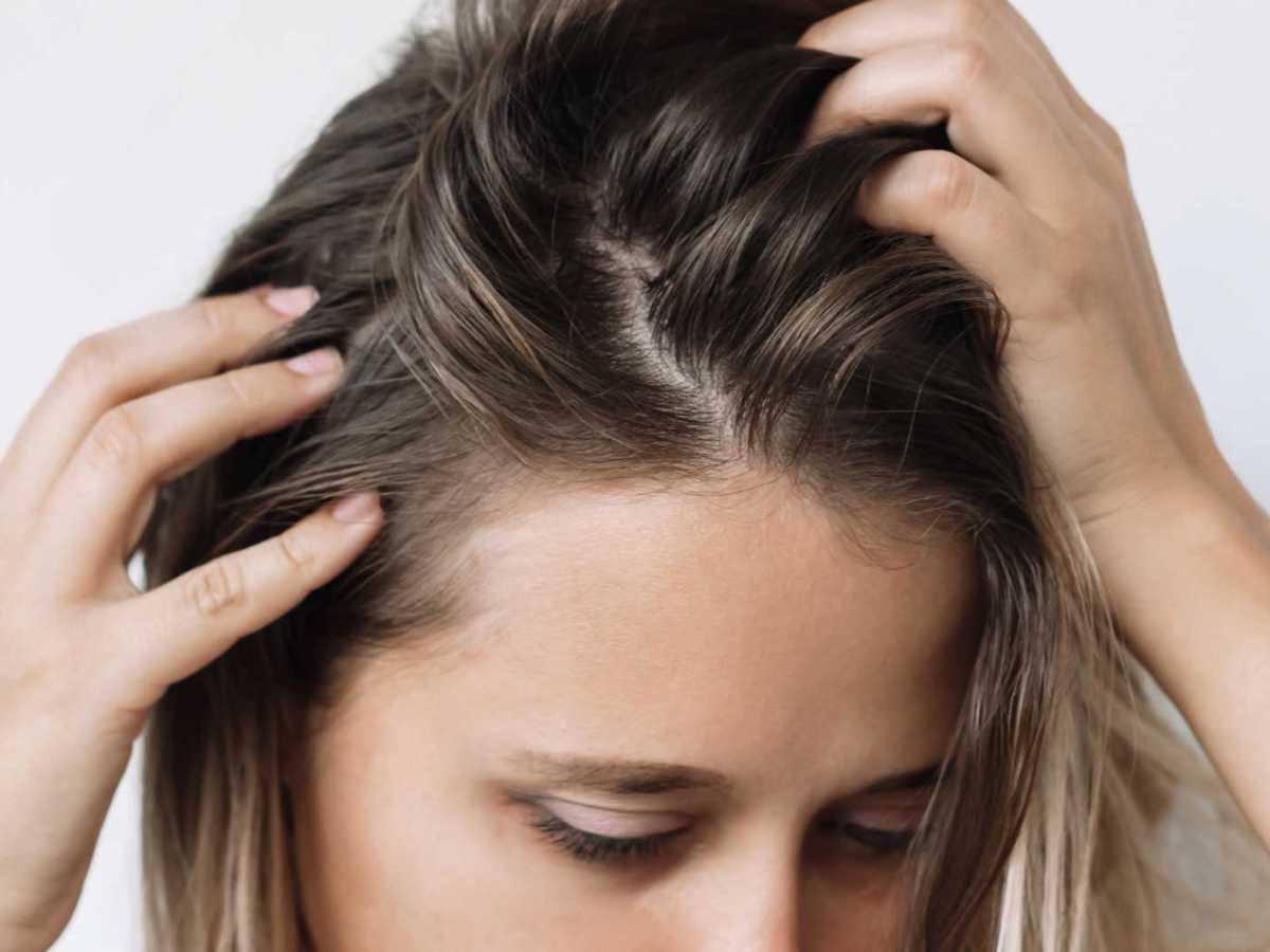 Frau mit Schuppen und fettigen Haaren fasst sich an die Kopfhaut.